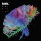 Muse - Madnes